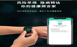 应之手表图片